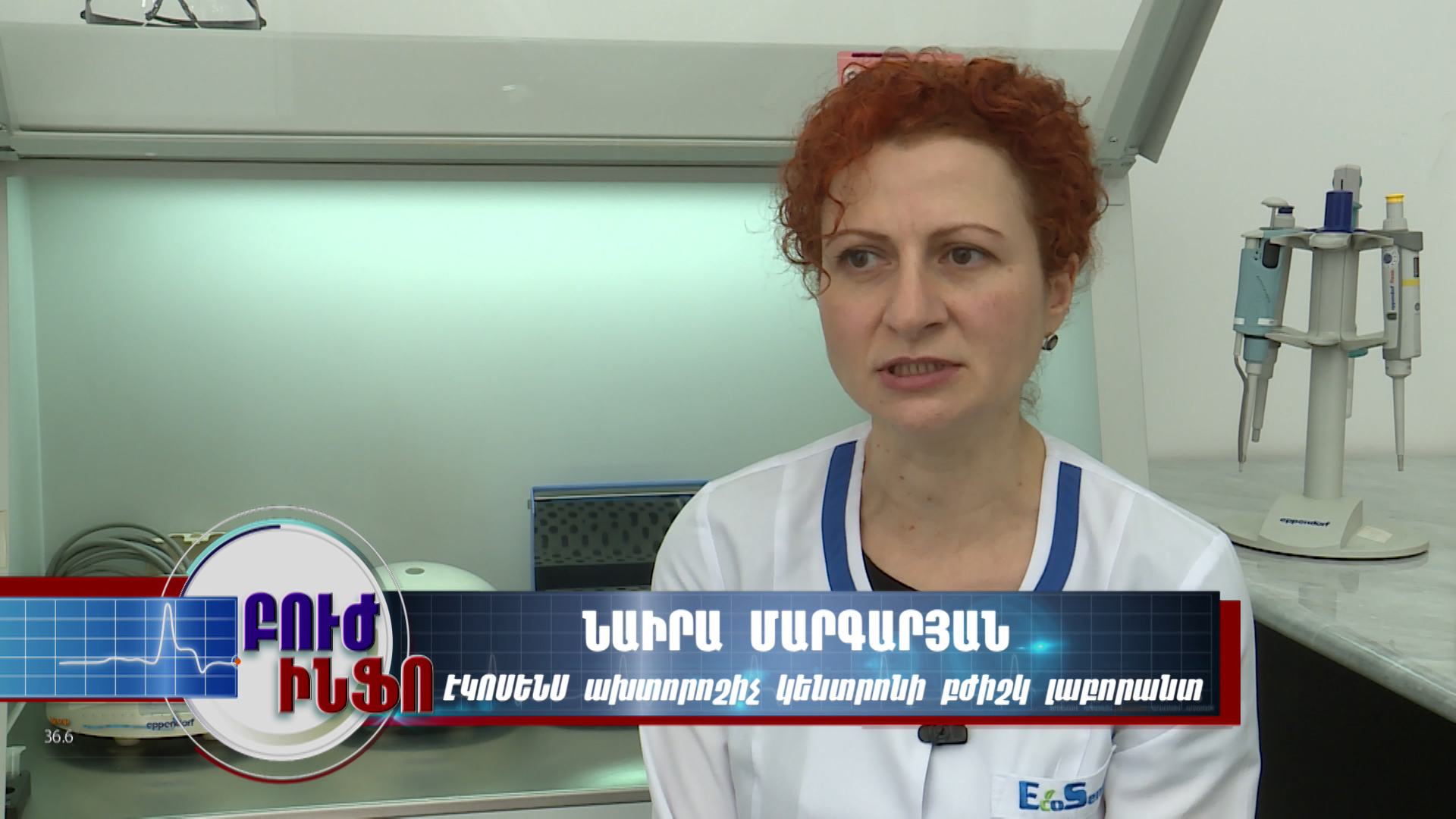 23.05.2017-C ռեակտիվ սպիտակուց